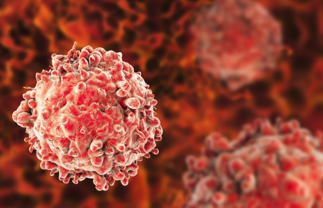 Người đ&agrave;n &ocirc;ng 65 tuổi ph&aacute;t hiện ung thư dương vật từ dấu hiệu nhiều nam giới Việt bỏ qua - Ảnh 2.