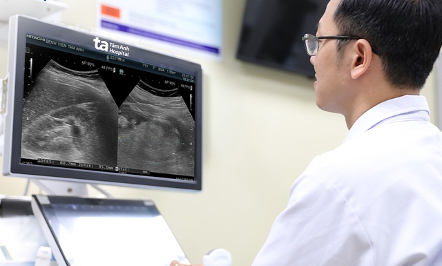 Người phụ nữ đột ngột vỡ u thận khi đang tắm: Bác sĩ cảnh báo biến chứng dễ gây tử vong - Ảnh 1. Người phụ nữ đột ngột vỡ u thận khi đang tắm: Bác sĩ cảnh báo biến chứng dễ gây tử vong - Ảnh 1.