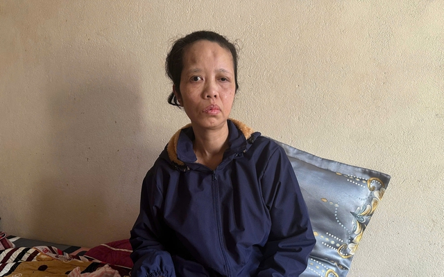 V&ograve;ng tay nh&acirc;n &aacute;i: Gi&uacute;p đỡ người phụ nữ đơn th&acirc;n chữa u n&atilde;o năm 2026 - Ảnh 3.