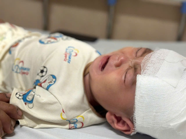 MS 1081: B&eacute; trai 1 tuổi nguy kịch sau tai nạn, gia đ&igrave;nh ngh&egrave;o khẩn cầu sự gi&uacute;p đỡ - Ảnh 2.