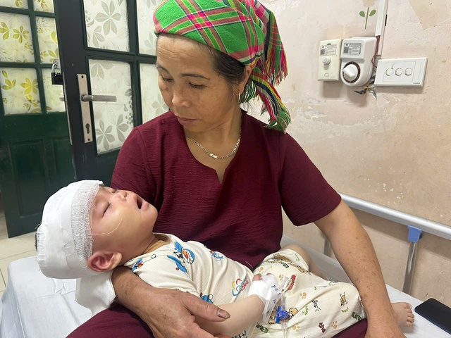 MS 1081: B&eacute; trai 1 tuổi nguy kịch sau tai nạn, gia đ&igrave;nh ngh&egrave;o khẩn cầu sự gi&uacute;p đỡ - Ảnh 3.