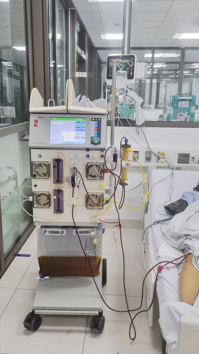 Suy gan cấp, ngộ độc nặng dịp nghỉ lễ: Cảnh b&aacute;o nguy cơ từ những th&oacute;i quen nhiều người Việt mắc phải - Ảnh 2.