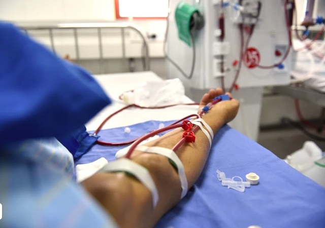 Người bệnh suy thận ăn ổi cần biết điều n&agrave;y để duy tr&igrave; chức năng thận - Ảnh 1.