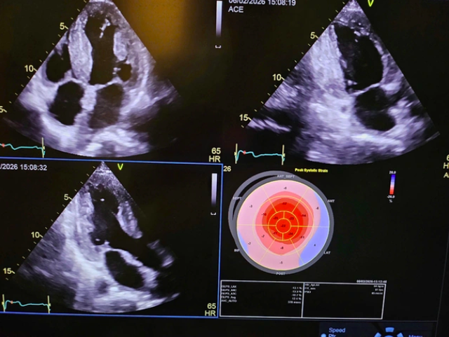 Từ ca ghép tạng domino đến hợp tác hỗ trợ chuyên môn y tế - Ảnh 2. Từ ca ghép tạng domino đến hợp tác hỗ trợ chuyên môn y tế - Ảnh 2.