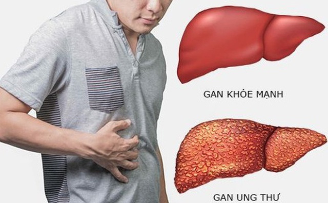 Người đàn ông 49 tuổi phát hiện ung thư gan, thừa nhận 1 thói quen trước khi ngủ nhiều người Việt mắc phải - Ảnh 2. Người đàn ông 49 tuổi phát hiện ung thư gan, thừa nhận 1 thói quen trước khi ngủ nhiều người Việt mắc phải - Ảnh 2.