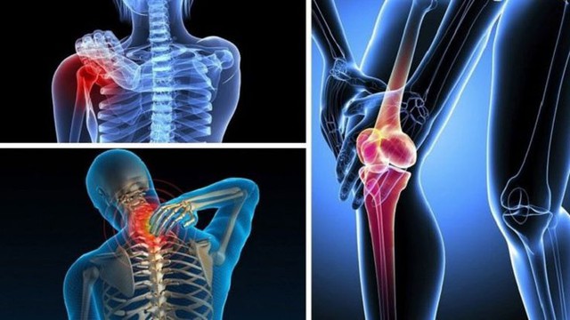 Đau xương kéo dài uống canxi không đỡ? Bác sĩ cảnh báo 6 dấu hiệu ung thư xương giai đoạn đầu dễ bị bỏ qua - Ảnh 1. Đau xương kéo dài uống canxi không đỡ? Bác sĩ cảnh báo 6 dấu hiệu ung thư xương giai đoạn đầu dễ bị bỏ qua - Ảnh 1.