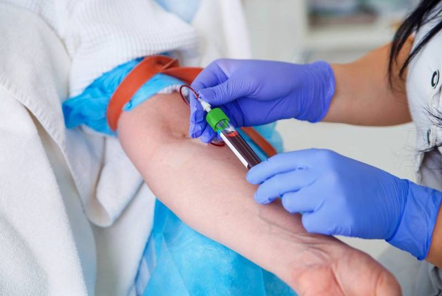 PGS Nguyễn L&acirc;n Hiếu cảnh b&aacute;o: Một sai số nhỏ khi x&eacute;t nghiệm m&aacute;u tại nh&agrave; cũng c&oacute; thể khiến người bệnh tưởng suy thận, ung thư - Ảnh 1.