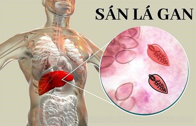 Người đ&agrave;n &ocirc;ng 42 tuổi ph&aacute;t hiện tổn thương gan v&igrave; th&oacute;i quen ăn rau nhiều người Việt mắc phải - Ảnh 1.