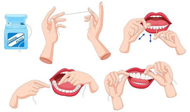 Những điều cần lưu &yacute; khi d&ugrave;ng chỉ nha khoa để bảo vệ sức khỏe răng miệng - Ảnh 3.