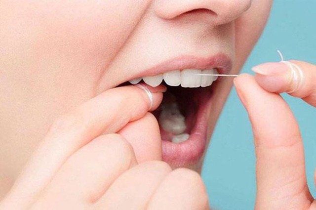 Những điều cần lưu &yacute; khi d&ugrave;ng chỉ nha khoa để bảo vệ sức khỏe răng miệng - Ảnh 1.