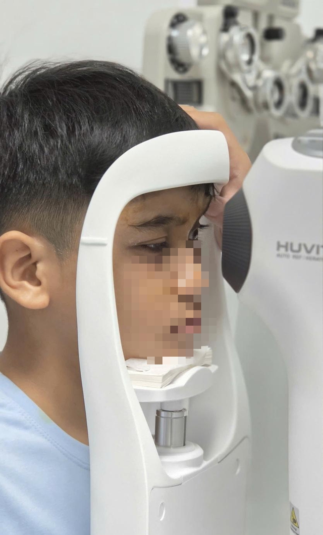 B&eacute; trai 10 tuổi cải thiện thị lực sau phẫu thuật đục thủy tinh thể phức tạp - Ảnh 2.