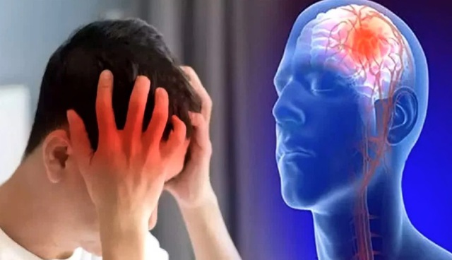Người đàn ông 3 lần đột quỵ ở tuổi 40, bác sĩ phát hiện nguyên nhân - Ảnh 1. Người đàn ông 3 lần đột quỵ ở tuổi 40, bác sĩ phát hiện nguyên nhân - Ảnh 1.