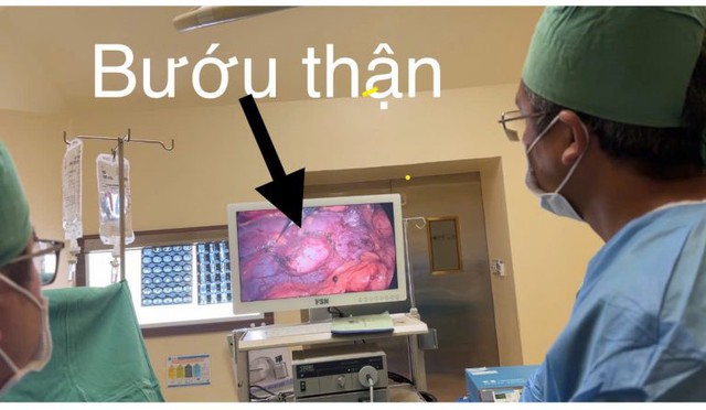 Người phụ nữ 41 tuổi ph&aacute;t hiện ung thư thận giai đoạn sớm từ dấu hiệu nhiều người Việt bỏ qua - Ảnh 1.