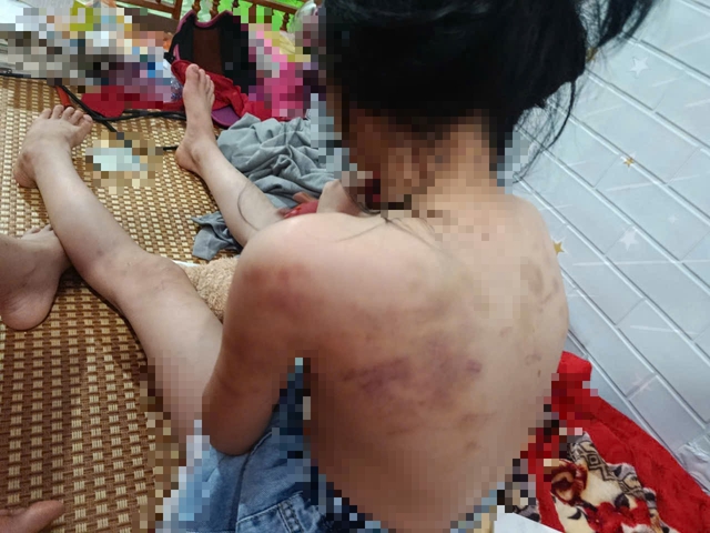 Cao Bằng: Nữ sinh lớp 4 bị bạn đ&aacute;nh đập , sự thật đau l&ograve;ng được phơi b&agrave;y - Ảnh 1.