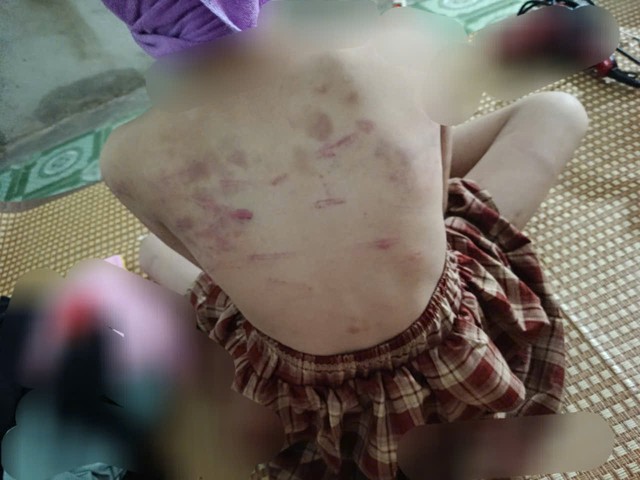 Vụ nữ sinh lớp 4 ở Cao Bằng bị đ&aacute;nh: Nỗi lo về bạo lực học đường 2026 - Ảnh 1.