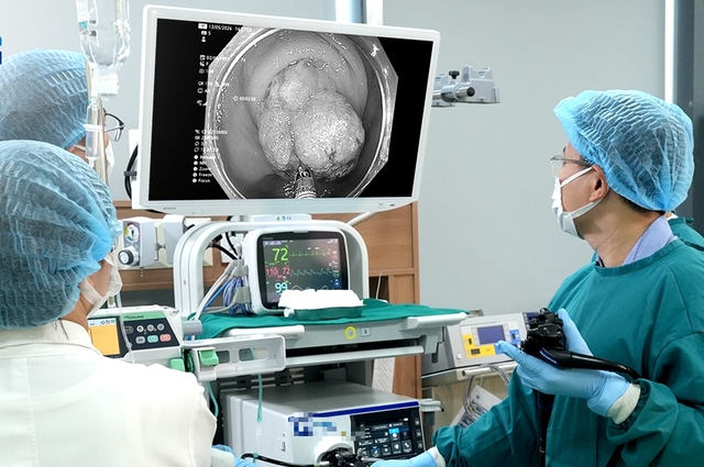 Đau bụng, người phụ nữ đi kh&aacute;m ph&aacute;t hiện tổn thương tiền ung thư ở vị tr&iacute; kh&oacute; ngờ - Ảnh 1.