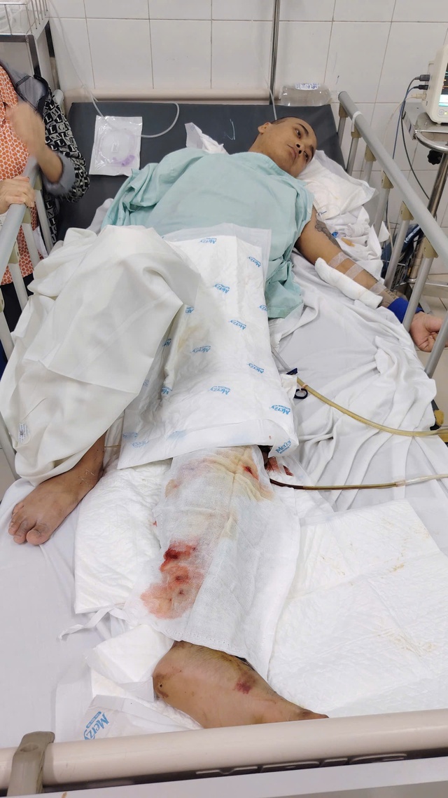MS 1090: Trên đường thăm hai con nhỏ, người cha trẻ gặp nạn nguy kịch, mẹ già bất lực trước chi phí điều trị - Ảnh 2. MS 1090: Trên đường thăm hai con nhỏ, người cha trẻ gặp nạn nguy kịch, mẹ già bất lực trước chi phí điều trị - Ảnh 2.