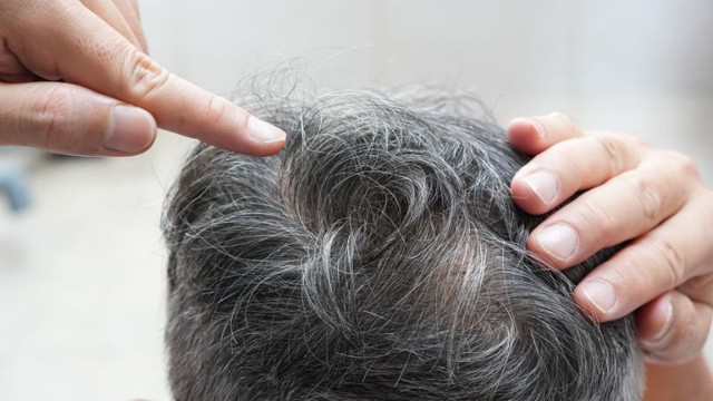 Trẻ ra v&agrave;i tuổi nhờ loại quả rẻ tiền n&agrave;y gi&uacute;p "nhuộm đen" m&aacute;i t&oacute;c bạc sớm - Ảnh 2.