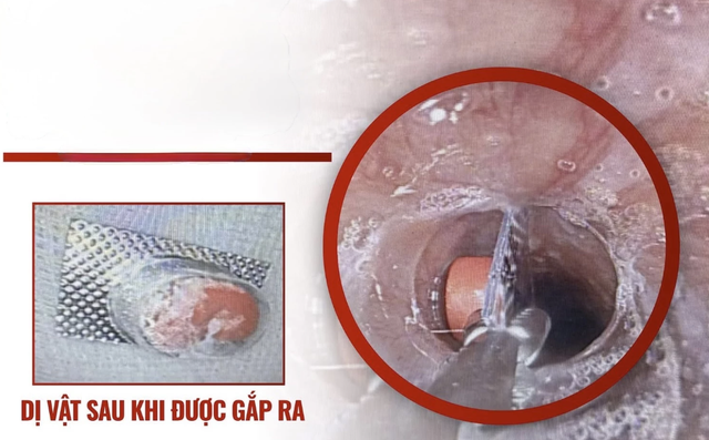 Tin s&aacute;ng 22/6: Th&ocirc;ng b&aacute;o quan trọng về tiền lương, lương hưu từ 1/7; 4 trường hợp bị tạm ho&atilde;n xuất cảnh do nợ thuế - Ảnh 4.