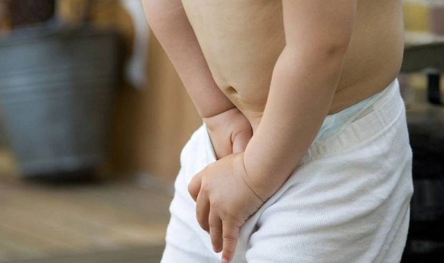 B&eacute; trai 11 tuổi mặc cảm v&igrave; dị tật v&ugrave;ng k&iacute;n, gia đ&igrave;nh hối tiếc v&igrave; tr&igrave; ho&atilde;n điều trị v&igrave; nghĩ trẻ lớn l&ecirc;n sẽ tự khỏi - Ảnh 1.