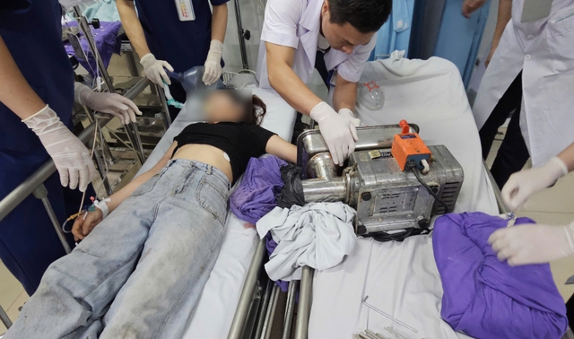 C&ocirc; g&aacute;i 19 tuổi nguy cơ mất b&agrave;n tay vĩnh viễn v&igrave; sơ suất trong l&uacute;c d&ugrave;ng m&aacute;y xay - Ảnh 1.