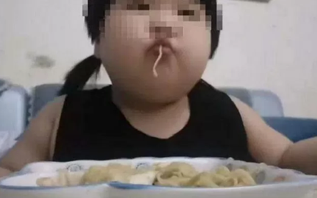 Bé gái 8 tuổi mắc gan nhiễm mỡ, bác sĩ chỉ ra sai lầm trong bữa ăn khiến nhiều phụ huynh chủ quan - Ảnh 1.