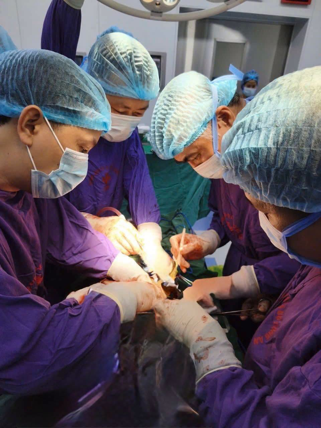 Tự ý dùng thuốc Nam sau ung thư gan, người đàn ông mang khối u tái phát nặng 3,5kg trong ổ bụng - Ảnh 1.
