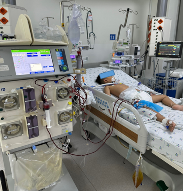 Bé trai 4 tuổi suy gan cấp, phải lọc máu liên tục vì được cho uống paracetamol hạ sốt 3 tiếng/lần - Ảnh 1.