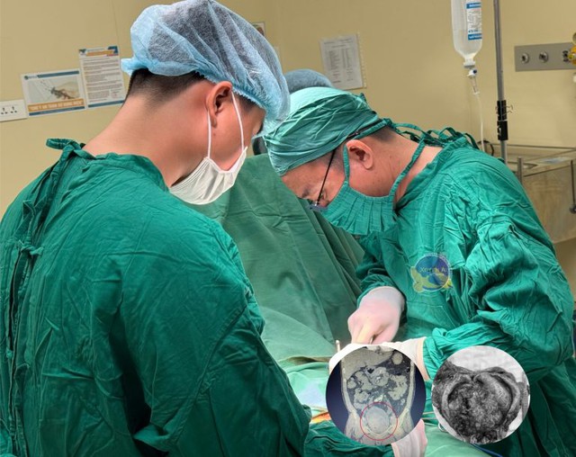 Người đ&agrave;n &ocirc;ng 54 tuổi ph&aacute;t hiện ung thư b&agrave;ng quang từ dấu hiệu nhiều người Việt mắc phải - Ảnh 1.