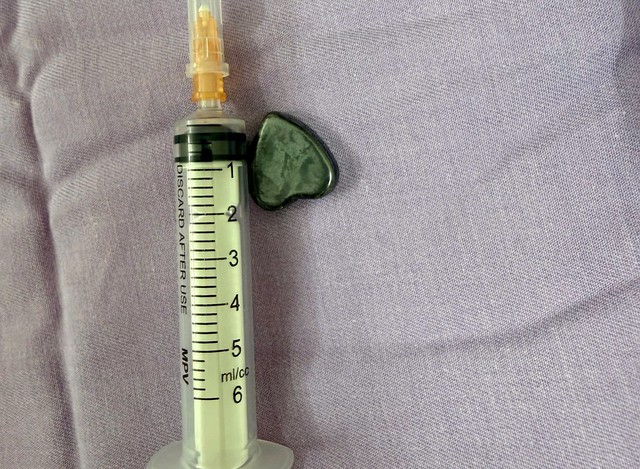 B&eacute; trai 15 th&aacute;ng tuổi nuốt cục nam ch&acirc;m h&igrave;nh tr&aacute;i tim, b&aacute;c sĩ khẩn cấp can thiệp trong đ&ecirc;m - Ảnh 2.