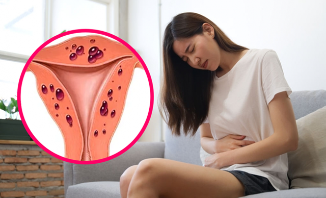 Người phụ nữ 39 tuổi ph&aacute;t hiện tử cung to như mang thai 3 th&aacute;ng từ dấu hiệu nhiều chị em Việt bỏ qua - Ảnh 1.