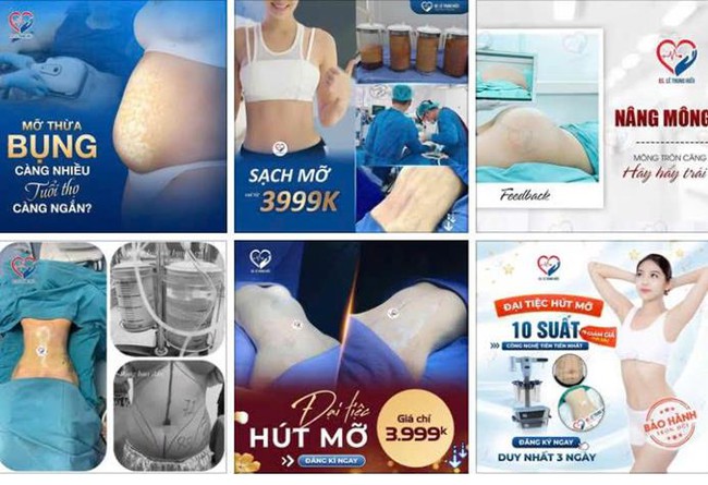 Người từng h&uacute;t mỡ tại Julia Aesthetic ở H&agrave; Nội cần biết th&ocirc;ng tin n&agrave;y - Ảnh 2.