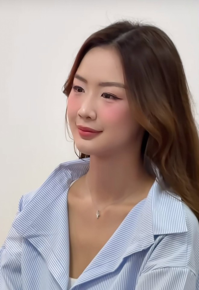 Đ&ocirc;i mắt sưng đỏ của Bảo Ngọc sau đ&ecirc;m chung kết Miss World 2026 g&acirc;y ch&uacute; &yacute; - Ảnh 7.