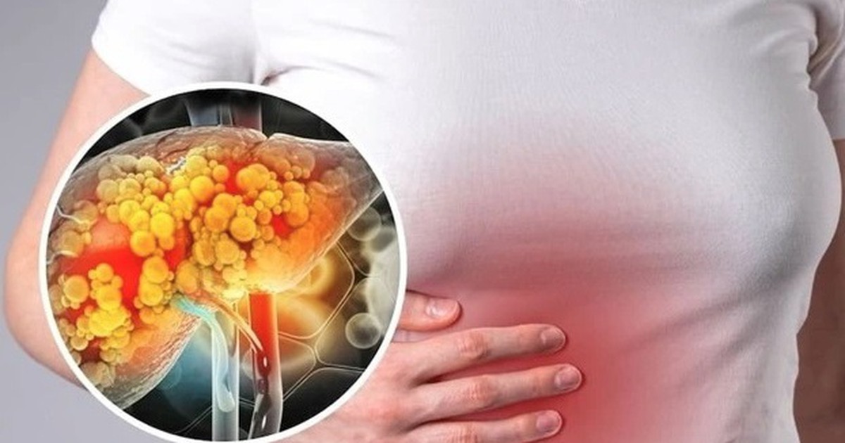 6 cách ngăn ngừa và kiểm soát bệnh gan nhiễm mỡ an toàn và hiệu quả
