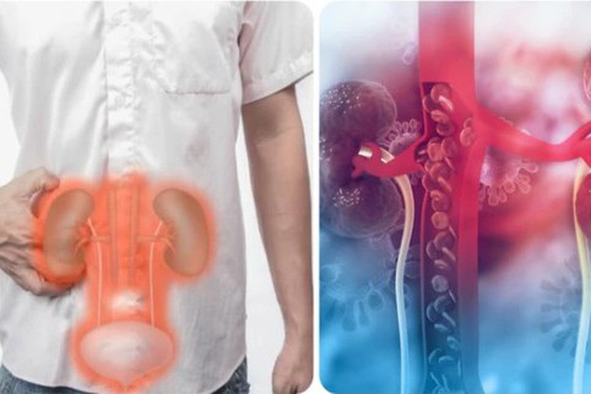 Thanh niên 20 tuổi suy thận giai đoạn cuối thừa nhận một sai lầm nhiều người Việt mắc phải