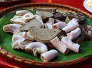 Lý do khiến bạn lâm vào tình trạng thừa cholesterol