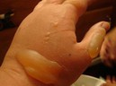 7 sai lầm trong trị bệnh gây hậu quả nặng nề cho trẻ mà cha mẹ hay mắc