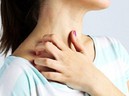 Cải thiện mề đay mạn tính hiệu quả, hạn chế tái phát với giải pháp thảo dược
