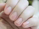 Người có mạch máu thông suốt, khỏe mạnh thường có chung 3 dấu hiệu nhỏ này ở ngón tay: Nếu có đủ, bạn có tiềm năng trường thọ rất cao!