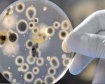 Mỹ phát hiện ca bệnh nấm nguy hiểm chết người có thể 'kháng mọi loại thuốc'