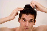 Tìm thấy hy vọng sau 8 năm trường rụng tóc Tìm thấy hy vọng sau 8 năm trường rụng tóc