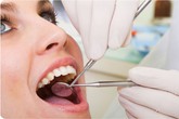 Những điều cần biết khi nhổ răng khôn Những điều cần biết khi nhổ răng khôn
