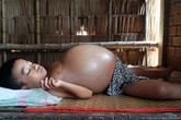 Vòng tay nhân ái: Gần 40 triệu đồng đến với cậu bé bụng to như trống Vòng tay nhân ái: Gần 40 triệu đồng đến với cậu bé bụng to như trống