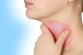 Hỏi và đáp về bệnh viêm thanh quản Hỏi và đáp về bệnh viêm thanh quản