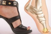 5 lý do khiến bạn không nên mang giày cao gót 5 lý do khiến bạn không nên mang giày cao gót