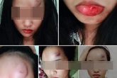 Con dâu bị bố chồng đạp vào mặt chỉ vì muốn bật điều hòa? Con dâu bị bố chồng đạp vào mặt chỉ vì muốn bật điều hòa?