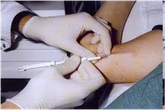 Lý giải việc “cấy que tránh thai mà vẫn dính bầu” ở Đà Nẵng Lý giải việc “cấy que tránh thai mà vẫn dính bầu” ở Đà Nẵng