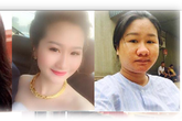 Tâm sự gây bão của hotgirl từ xinh lung linh đến "xấu không nhận ra" sau khi làm mẹ Tâm sự gây bão của hotgirl từ xinh lung linh đến "xấu không nhận ra" sau khi làm mẹ