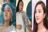 "Nâng mũi 360 độ" bắt đầu "gây sốt" các tín đồ làm đẹp "Nâng mũi 360 độ" bắt đầu "gây sốt" các tín đồ làm đẹp