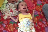 Xót xa bé trai 1 tuổi vật lộn cùng khối u não Xót xa bé trai 1 tuổi vật lộn cùng khối u não